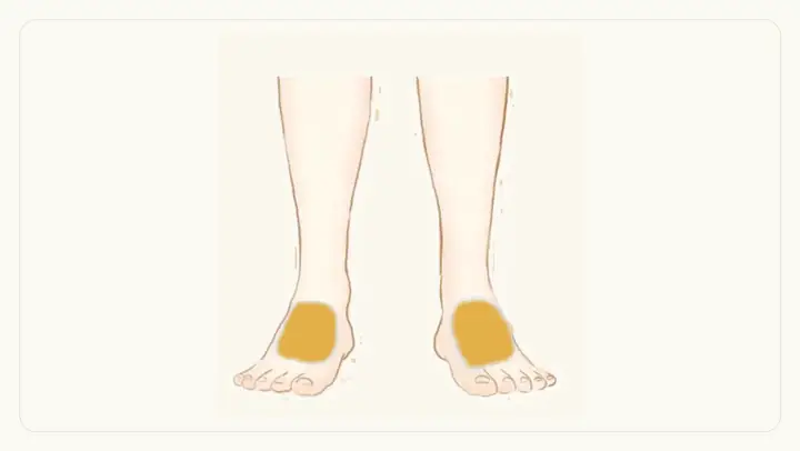 両足の甲の脱毛範囲イメージ