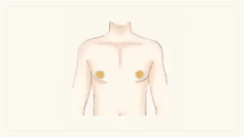乳首周り脱毛の施術範囲イメージ